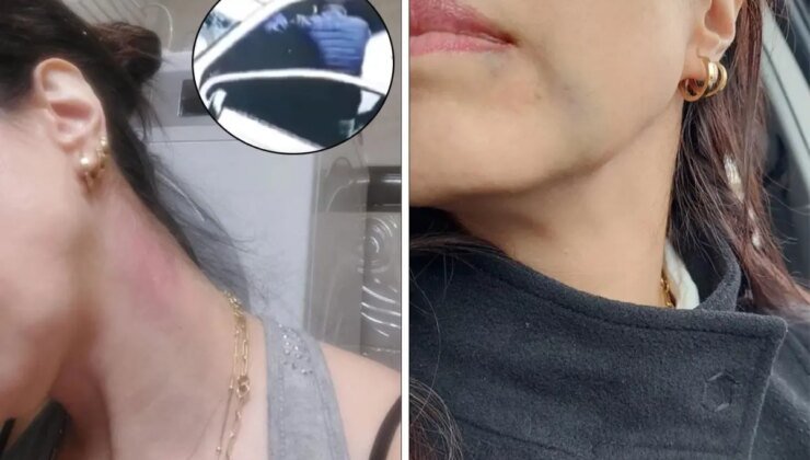 Astım hastası kadını öldüresiye dövdüler: "Beni öldü zannedip kaçtılar"