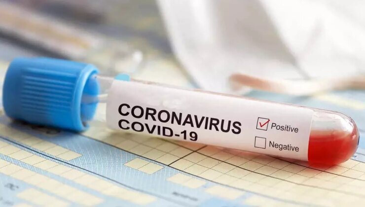 Dev tıbbi malzeme firması Türklab, konkordato ilan etti