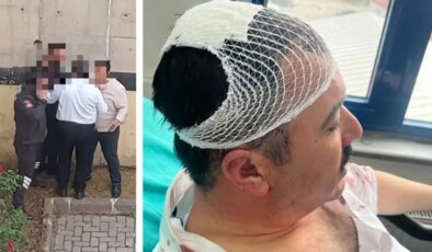 Yeniden Refah Partili başkan yardımcıları arasında kavga: Kafasını şekerlikle parçaladı