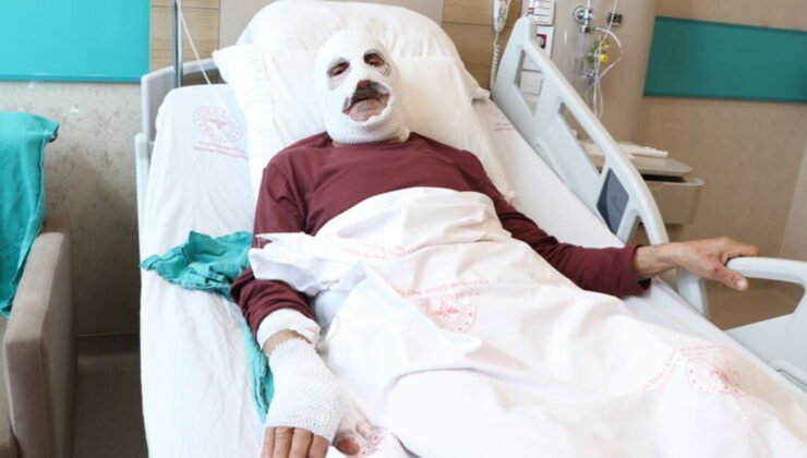 “Güm diye bir parlama oldu!” Çakmakla tüpü kontrol etti!