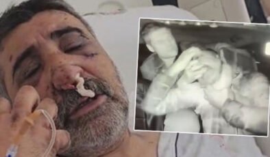 İngiliz boksörün darp ettiği taksici konuştu: Gözlerimi oymaya çalıştı!