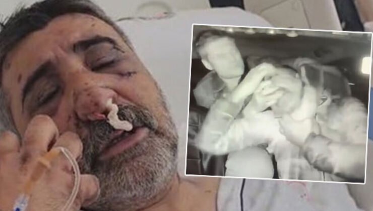 İngiliz boksörün darp ettiği taksici konuştu: Gözlerimi oymaya çalıştı!