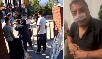 Turistlerden 4 fotoğraf için servet istediler, kavgada araya giren şoförün burnunu kırdılar