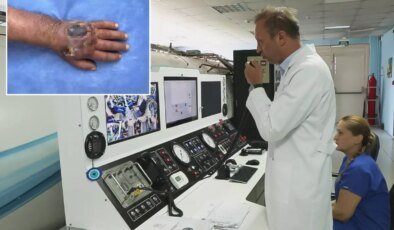 Doktorlar bile şaşırdı! Hırsız elini öyle bir ısırdı ki vaka literatüre girmeye hazırlanıyor