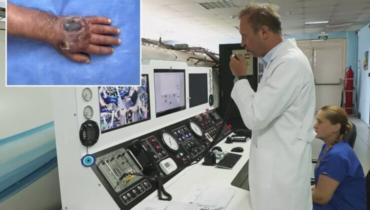 Doktorlar bile şaşırdı! Hırsız elini öyle bir ısırdı ki vaka literatüre girmeye hazırlanıyor