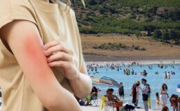 Et yiyen bakteri vakası Türkiye’de görüldü mü? Bakanlıktan açıklama