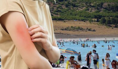 Et yiyen bakteri vakası Türkiye’de görüldü mü? Bakanlıktan açıklama