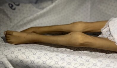 Gazze Şeridi’nde bir çocuk daha "açlıktan" öldü! 3 kiloya kadar düşmüştü
