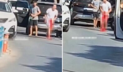 Kavgayı ayırmak isterken silahla vuruldu