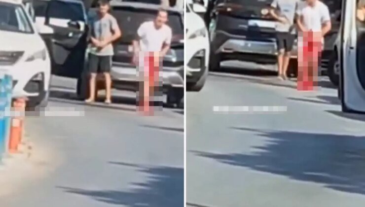 Kavgayı ayırmak isterken silahla vuruldu