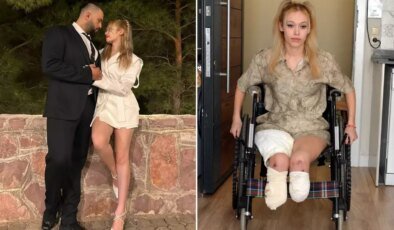 Evlilik yıl dönümünde kabusu yaşadı, 2 bacağını birden kaybetti