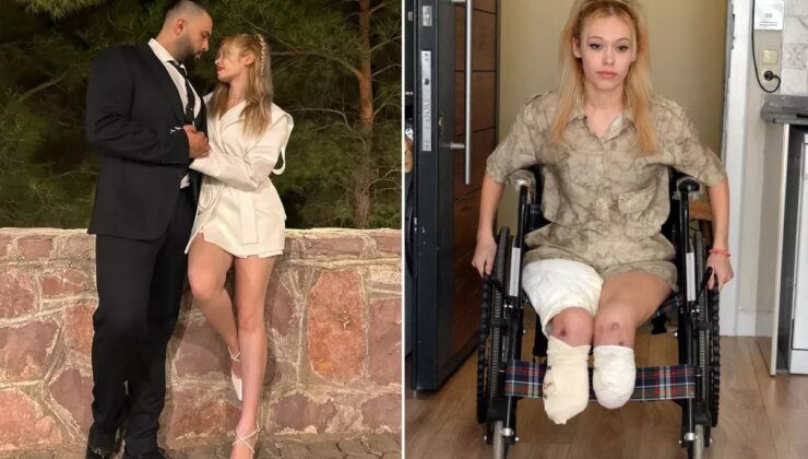 Evlilik yıl dönümünde kabusu yaşadı, 2 bacağını birden kaybetti