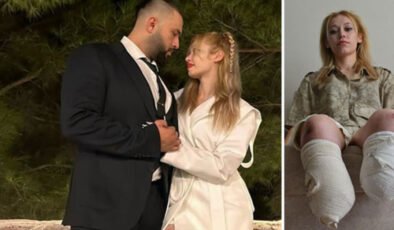 Evlilik yıl dönümünde kâbusu yaşadı! İki bacağını kaybetti…